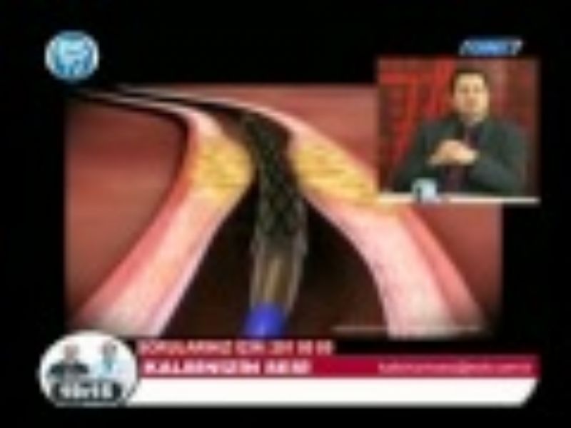 DR.ZCAN YCEL KALBNZN SESNDE